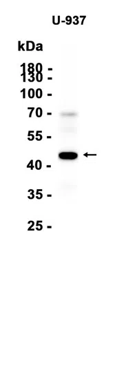 SerpinB2/PAI-2 Rabbit Monoclonal Antibody - Size: 50µl
