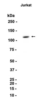 PKN Rabbit Monoclonal Antibody - Size: 100µl