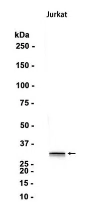 Caspase-6 Rabbit Monoclonal Antibody - Size: 50µl