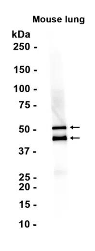 Cytokeratin 7 Rabbit Monoclonal Antibody - Size: 100µl