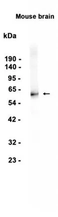 GAD65 Rabbit Monoclonal Antibody - Size: 100µl