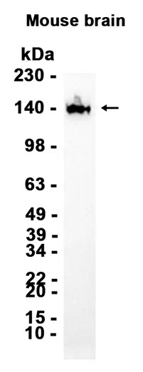 LATS1/WARTS Rabbit Monoclonal Antibody - Size: 50µl