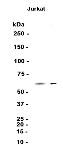 PKM Rabbit Monoclonal Antibody - Size: 50µl