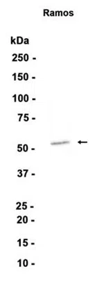 LSP1 Rabbit Monoclonal Antibody - Size: 100µl