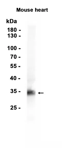 gamma Sarcoglycan Rabbit Monoclonal Antibody - Size: 100µl
