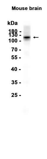 GRID2 Rabbit Monoclonal Antibody - Size: 100µl