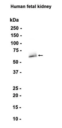 TGFBI Rabbit Monoclonal Antibody - Size: 100µl
