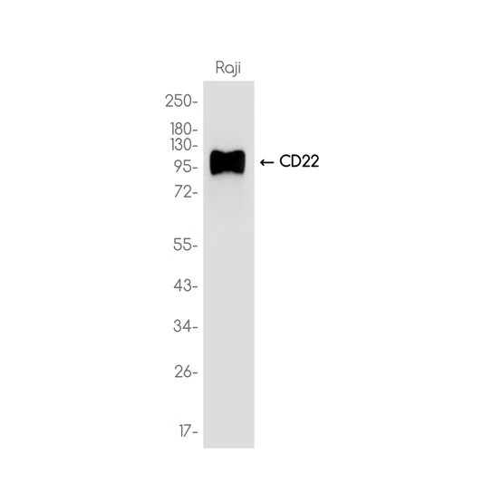 CD22 Rabbit Monoclonal Antibody - Size: 50µl