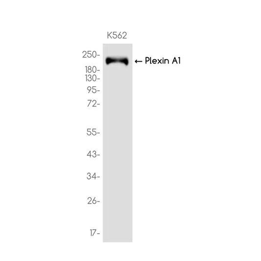 Plexin A1 Rabbit Monoclonal Antibody - Size: 100µl