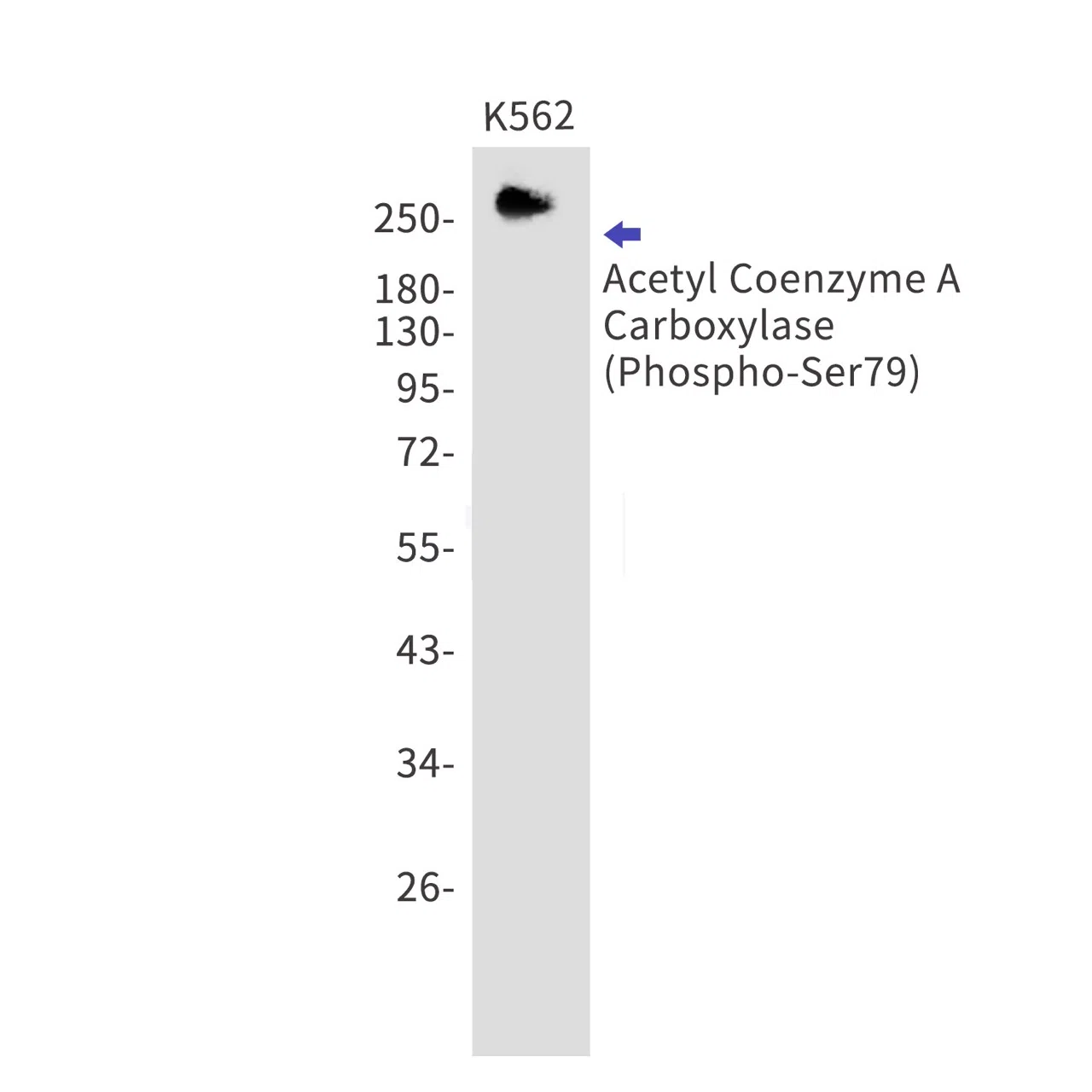 Phospho-Acetyl Coenzyme A Carboxylase (Ser79) Rabbit Monoclonal Antibody