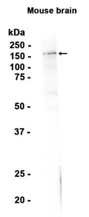 nNOS (neuronal) Rabbit Monoclonal Antibody - Size: 100µl