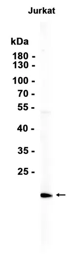 Rho Rabbit Monoclonal Antibody - Size: 100µl