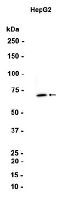 PMP70 Rabbit Monoclonal Antibody - Size: 50µl