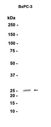 MMP7 Rabbit Monoclonal Antibody - Size: 50µl