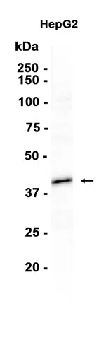 DAPK2 Rabbit Monoclonal Antibody - Size: 50µl
