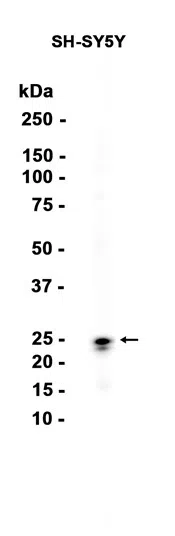 TPPP Rabbit Monoclonal Antibody - Size: 100µl