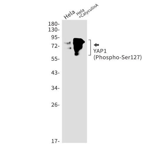 Phospho-YAP1 (Ser127) Rabbit Monoclonal Antibody - Size: 100µl