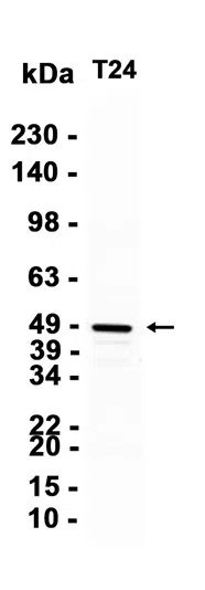SerpinB2/PAI-2 Rabbit Monoclonal Antibody - Size: 100µl