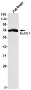 BACE1 Rabbit Monoclonal Antibody - Size: 100µl