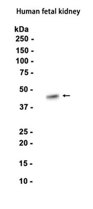 ENTPD5 Rabbit Monoclonal Antibody - Size: 100µl