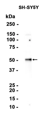 Argininosuccinate Lyase Rabbit Monoclonal Antibody - Size: 100µl