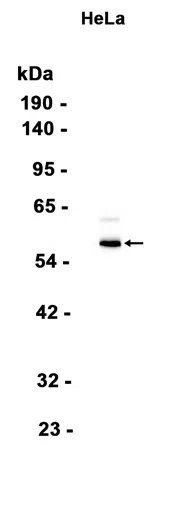 TCP1 alpha/CCTA Rabbit Monoclonal Antibody - Size: 50µl