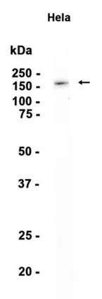 CD103 Rabbit Monoclonal Antibody - Size: 100µl