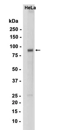 UBF1 Rabbit Monoclonal Antibody - Size: 100µl