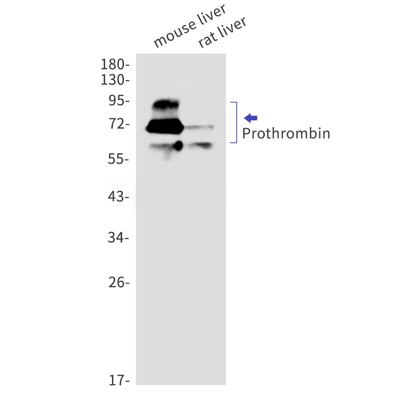 Prothrombin Rabbit Monoclonal Antibody - Size: 50µl