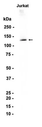 SUPT16H Rabbit Monoclonal Antibody - Size: 100µl