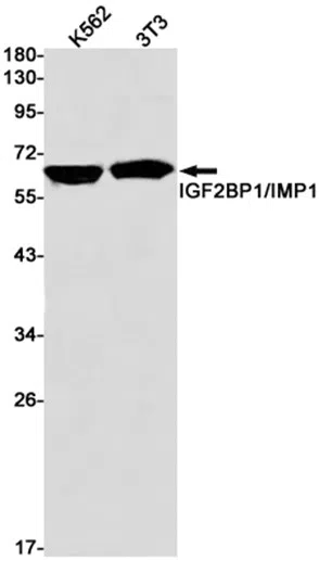 IGF2BP1 Rabbit Monoclonal Antibody - Size: 100µl