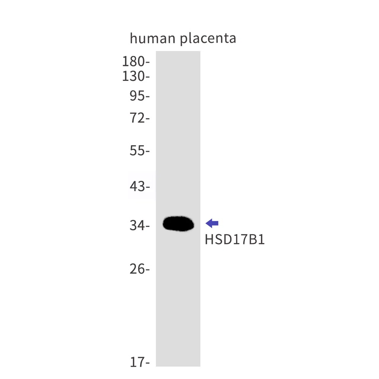 HSD17B1 Rabbit Monoclonal Antibody - Size: 50µl