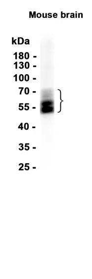Tau Rabbit Monoclonal Antibody - Size: 50µl