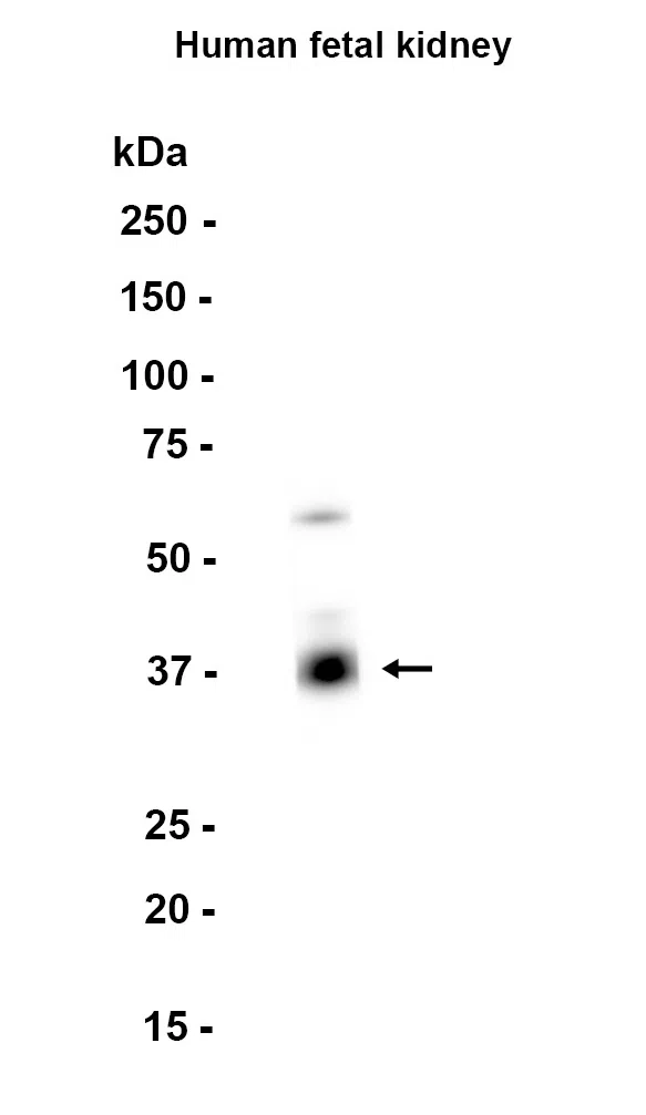 UCH37 Rabbit Monoclonal Antibody - Size: 50µl