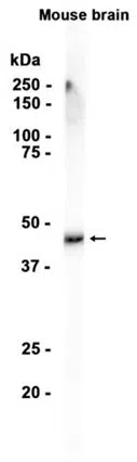 Neuroserpin Rabbit Monoclonal Antibody - Size: 50µl