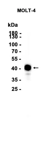 CD1c Rabbit Monoclonal Antibody