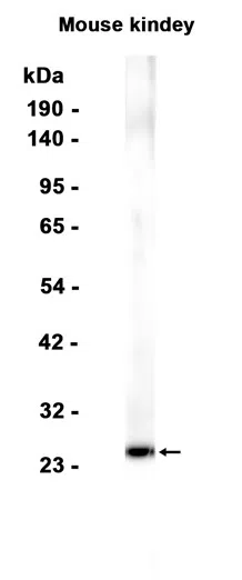SIRT3 Rabbit Monoclonal Antibody - Size: 50µl