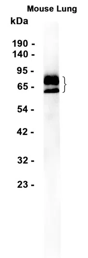 TGF beta Receptor II Rabbit Monoclonal Antibody - Size: 50µl