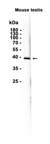 DMC1 Rabbit Monoclonal Antibody
