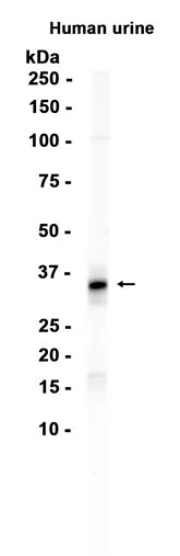 Ficolin 2 Rabbit Monoclonal Antibody