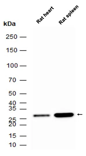 Carbonic Anhydrase 1/CA1 Rabbit Monoclonal Antibody - Size: 50µl