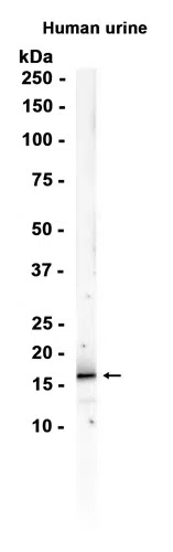 TFF2 Rabbit Monoclonal Antibody - Size: 100µl