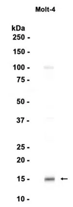 Ube2L6 Rabbit Monoclonal Antibody - Size: 50µl