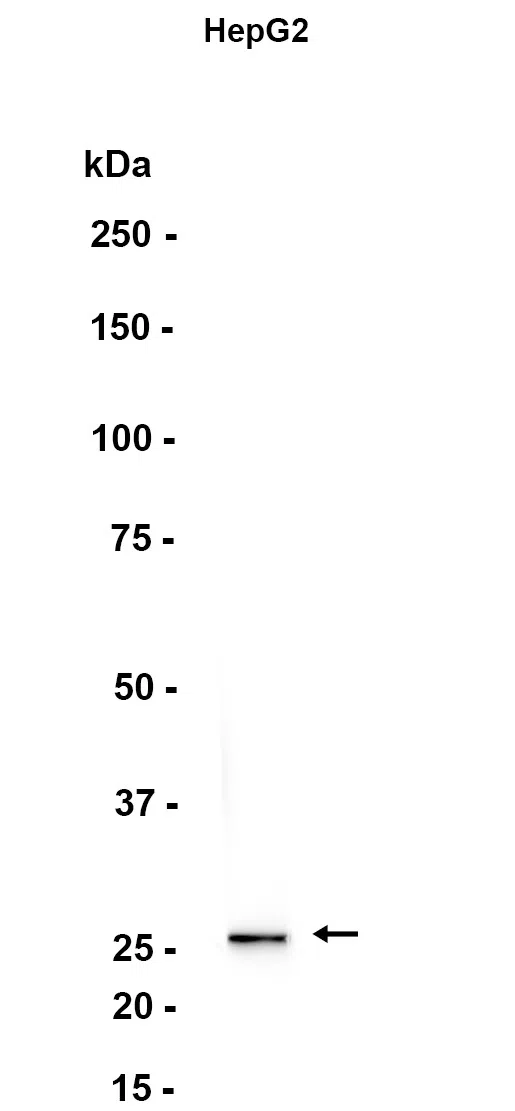 Proteasome 20S alpha 5/PSMA5 Rabbit Monoclonal Antibody - Size: 100µl