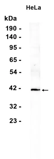 PAR4 Rabbit Monoclonal Antibody