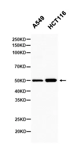 Mannose Phosphate Isomerase Rabbit Monoclonal Antibody - Size: 100µl