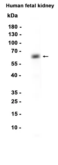 HNF-1B Rabbit Monoclonal Antibody - Size: 100µl