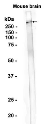 Versican Rabbit Monoclonal Antibody - Size: 100µl