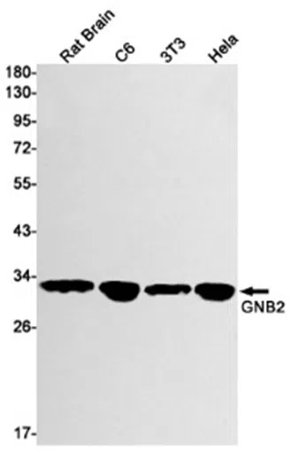 GNB2 Rabbit Monoclonal Antibody - Size: 50µl
