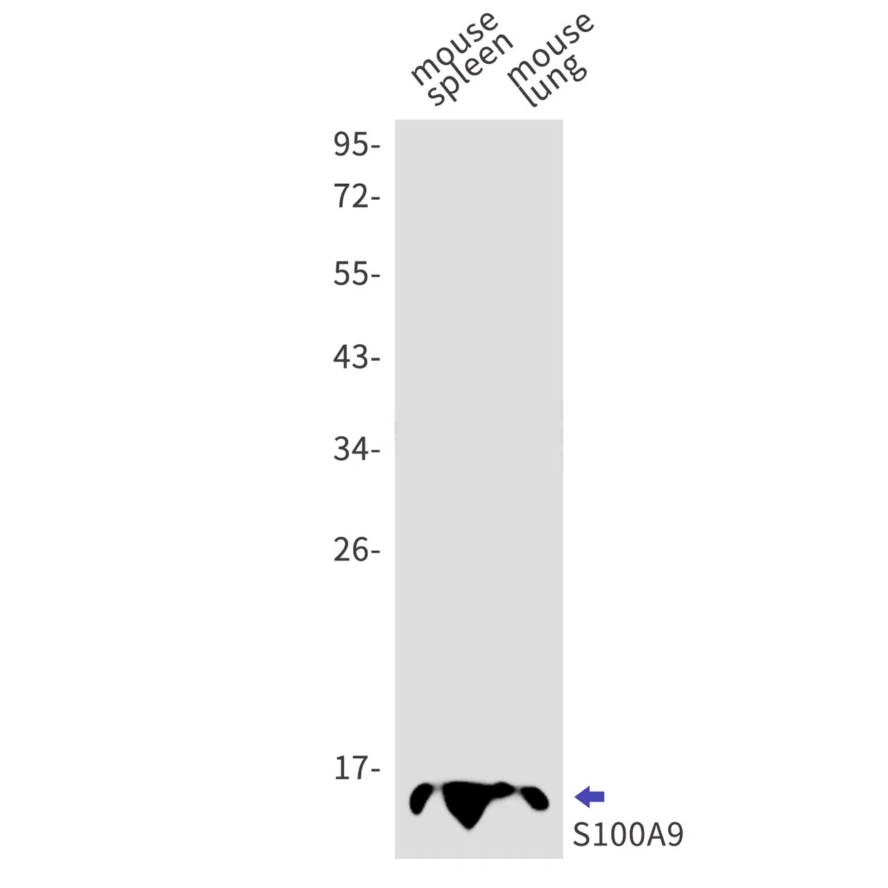S100A9 Rabbit Monoclonal Antibody - Size: 50µl